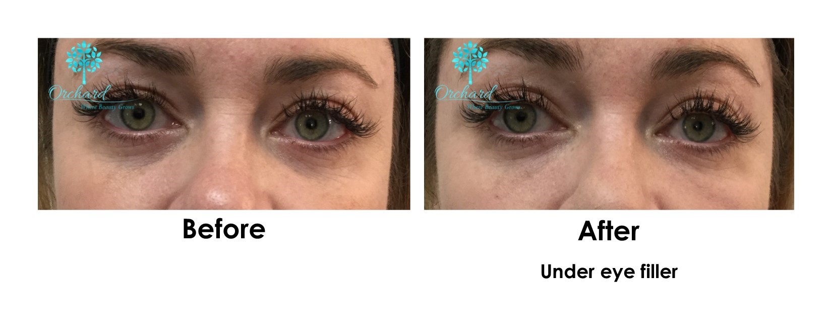 Our TOP FIVE Bright Eyes Treatments